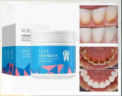 Отбеливающий порошок для зубов VEZE OEM ODM Фирменная торговая марка S4331 фото
